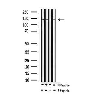 ABL1 / c-ABL Antibody - Western blot analysis of Phospho-Abl (Tyr412) expression in various lysates