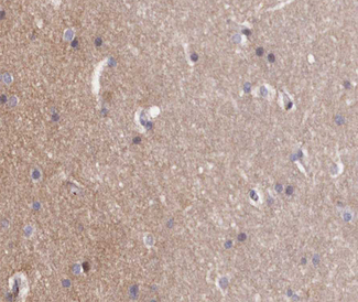 ABL1 / c-ABL Antibody - 1:200 staining human brain tissue by IHC-P. The tissue was formaldehyde fixed and a heat mediated antigen retrieval step in citrate buffer was performed. The tissue was then blocked and incubated with the antibody for 1.5 hours at 22°C. An HRP conjugated goat anti-rabbit antibody was used as the secondary.