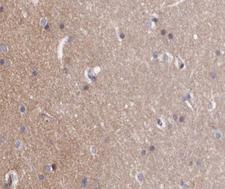 ABL1 / c-ABL Antibody - 1:200 staining human brain tissue by IHC-P. The tissue was formaldehyde fixed and a heat mediated antigen retrieval step in citrate buffer was performed. The tissue was then blocked and incubated with the antibody for 1.5 hours at 22°C. An HRP conjugated goat anti-rabbit antibody was used as the secondary.