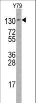 ABL2 Antibody - ABL2 non P-specific antibody western blot of Y79 cell line lysates (35 ug/lane). ABL2(arrow) was detected using the purified antibody.