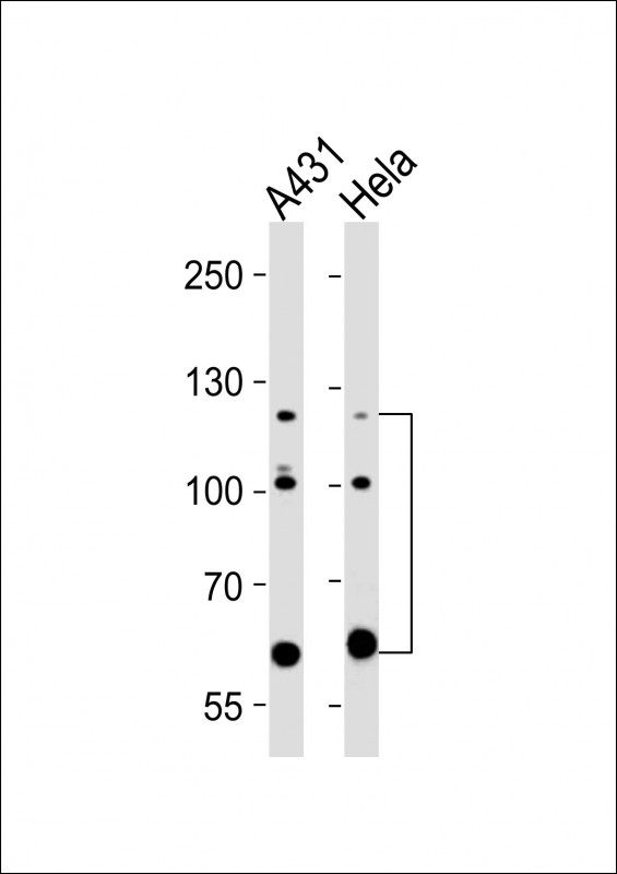ABL2 Antibody - All lanes : Anti-ABL2 Antibody at 1:2000 dilution Lane 1: A431 whole cell lysates Lane 2: HeLa whole cell lysates Lysates/proteins at 20 ug per lane. Secondary Goat Anti-Rabbit IgG, (H+L), Peroxidase conjugated at 1/10000 dilution Predicted band size : 128 kDa Blocking/Dilution buffer: 5% NFDM/TBST.
