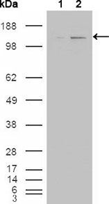 ABL2 Antibody - Abl2 Antibody in Western Blot (WB)