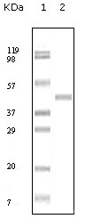 ABL2 Antibody - Western blot using ABL2 mouse monoclonal antibody against truncated ABL2 recombinant protein.