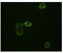 ABL2 Antibody - Immunofluorescence staining of methanol-fixed HeLa cells using ABL2 mouse monoclonal antibody showing cytoplasm localization.