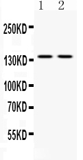 ABL2 Antibody - Western blot analysis of ABL2 using anti-ABL2 antibody. Electrophoresis was performed on a 5-20% SDS-PAGE gel at 70V (Stacking gel) / 90V (Resolving gel) for 2-3 hours. The sample well of each lane was loaded with 50ug of sample under reducing conditions. Lane 1: mouse brain tissue lysates, Lane 2: HELA whole cell lysates, After Electrophoresis, proteins were transferred to a Nitrocellulose membrane at 150mA for 50-90 minutes. Blocked the membrane with 5% Non-fat Milk/ TBS for 1.5 hour at RT. The membrane was incubated with rabbit anti-ABL2 antigen affinity purified polyclonal antibody at 0.5 µg/mL overnight at 4°C, then washed with TBS-0.1% Tween 3 times with 5 minutes each and probed with a goat anti-rabbit IgG-HRP secondary antibody at a dilution of 1:10000 for 1.5 hour at RT. The signal is developed using an Enhanced Chemiluminescent detection (ECL) kit with Tanon 5200 system. A specific band was detected for ABL2 at approximately 140KD. The expected band size for ABL2 is at 128KD.