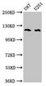 ABL2 Antibody - Positive Western Blot detected in U87 whole cell lysate, U251 whole cell lysate. All lanes: ABL2 antibody at 4 µg/ml Secondary Goat polyclonal to rabbit IgG at 1/50000 dilution. Predicted band size: 129, 125, 127, 115, 118, 116, 117, 61KDa. Observed band size: 125 KDa