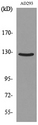 ABL2 Antibody - Western blot analysis of lysate from AD293 cells, using ABL2 Antibody.
