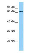 ABLIM1 Antibody - ABLIM1 antibody Western Blot of Mouse Heart.  This image was taken for the unconjugated form of this product. Other forms have not been tested.