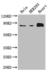 ABLIM1 Antibody - Positive WB detected in:Hela whole cell lysate,HEK293 whole cell lysate,Mouse heart tissue;All lanes: ABLIM1 antibody at 3.4ug/ml;Secondary;Goat polyclonal to rabbit IgG at 1/50000 dilution;Predicted band size: 88,82,49,47,53,85 kDa;Observed band size: 88 kDa;