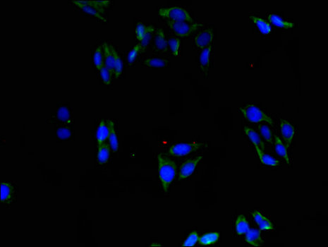 ABLIM1 Antibody - Immunofluorescent analysis of HepG2 cells using ABLIM1 Antibody at a dilution of 1:100 and Alexa Fluor 488-congugated AffiniPure Goat Anti-Rabbit IgG(H+L)