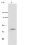ABLIM1 Antibody - Anti-ABLIM1 rabbit polyclonal antibody at 1:500 dilution. Lane A: HeLa Whole Cell Lysate. Lysates/proteins at 30 ug per lane. Secondary: Goat Anti-Rabbit IgG (H+L)/HRP at 1/10000 dilution. Developed using the ECL technique. Performed under reducing conditions. Predicted band size: 88 kDa. Observed band size: 88 kDa.
