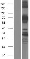 ABLIM2 Protein - Western validation with an anti-DDK antibody * L: Control HEK293 lysate R: Over-expression lysate