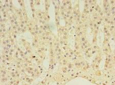 ABLIM3 Antibody - Immunohistochemistry of paraffin-embedded human adrenal gland tissue using antibody at dilution of 1:100.