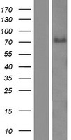 ABLIM3 Protein - Western validation with an anti-DDK antibody * L: Control HEK293 lysate R: Over-expression lysate