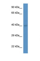 ABO Glycosyltransferase Antibody - ABO antibody Western blot of Mouse Spleen lysate. Antibody concentration 1 ug/ml. This image was taken for the unconjugated form of this product. Other forms have not been tested.