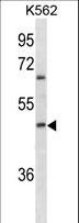 ABO Glycosyltransferase Antibody - ABO Antibody (Ascites)western blot of K562 cell line lysates (35 ug/lane). The ABO antibody detected the ABO protein (arrow).