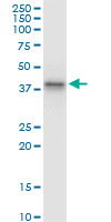 ABO Glycosyltransferase Antibody - ABO monoclonal antibody (M08), clone 1B7. Western Blot analysis of ABO expression in A-431.