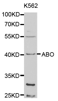 ABO Glycosyltransferase Antibody - Western blot analysis of extracts of K-562 cells, using ABO antibody at 1:1000 dilution. The secondary antibody used was an HRP Goat Anti-Rabbit IgG (H+L) at 1:10000 dilution. Lysates were loaded 25ug per lane and 3% nonfat dry milk in TBST was used for blocking.