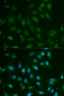 ABO Glycosyltransferase Antibody - Immunofluorescence analysis of MCF-7 cells using ABO antibody. Blue: DAPI for nuclear staining.