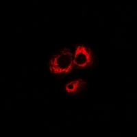 ABO Glycosyltransferase Antibody - Immunofluorescent analysis of ABO staining in MCF7 cells. Formalin-fixed cells were permeabilized with 0.1% Triton X-100 in TBS for 5-10 minutes and blocked with 3% BSA-PBS for 30 minutes at room temperature. Cells were probed with the primary antibody in 3% BSA-PBS and incubated overnight at 4 deg C in a humidified chamber. Cells were washed with PBST and incubated with a DyLight 594-conjugated secondary antibody (red) in PBS at room temperature in the dark.