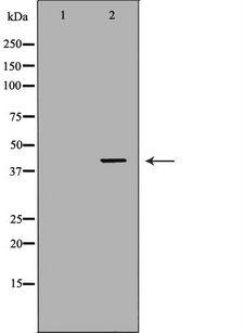 ABO Glycosyltransferase Antibody - Western blot analysis of extracts of K562 cells using ABO antibody. The lane on the left is treated with the antigen-specific peptide.