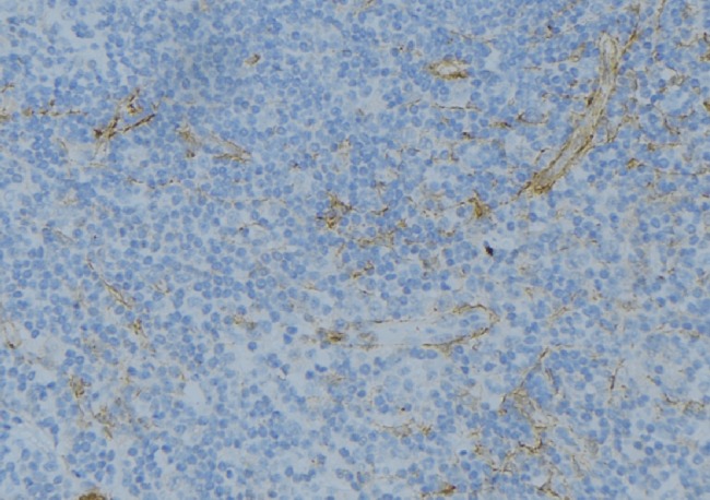 ABO Glycosyltransferase Antibody - 1:100 staining human lymph node tissue by IHC-P. The sample was formaldehyde fixed and a heat mediated antigen retrieval step in citrate buffer was performed. The sample was then blocked and incubated with the antibody for 1.5 hours at 22°C. An HRP conjugated goat anti-rabbit antibody was used as the secondary.