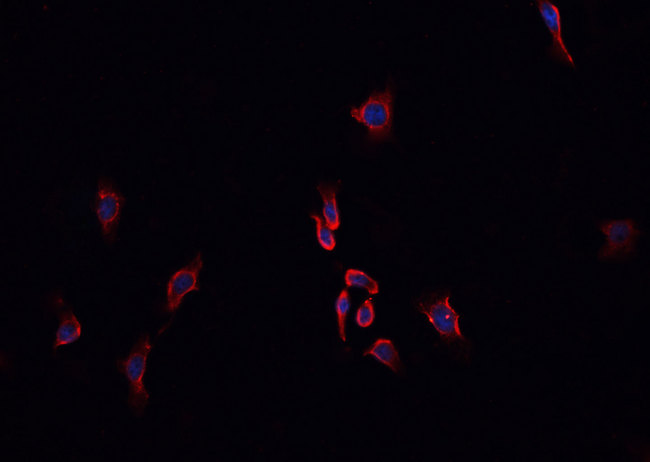 ABO Glycosyltransferase Antibody - Staining HepG2 cells by IF/ICC. The samples were fixed with PFA and permeabilized in 0.1% Triton X-100, then blocked in 10% serum for 45 min at 25°C. The primary antibody was diluted at 1:200 and incubated with the sample for 1 hour at 37°C. An Alexa Fluor 594 conjugated goat anti-rabbit IgG (H+L) antibody, diluted at 1/600, was used as secondary antibody.