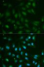 ABO Glycosyltransferase Antibody - Immunofluorescence analysis of MCF-7 cells using ABO Polyclonal Antibody.