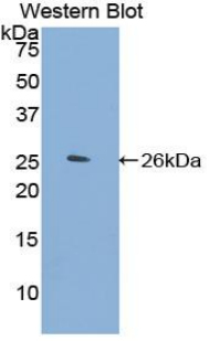 ABP-280 / FLNC Antibody - Western blot of recombinant ABP-280 / FLNC.  This image was taken for the unconjugated form of this product. Other forms have not been tested.