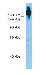 ABP-280 / FLNC Antibody - ABP-280 / FLNC antibody Western Blot of HepG2.  This image was taken for the unconjugated form of this product. Other forms have not been tested.