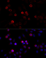 ABP-280 / FLNC Antibody - Immunofluorescence analysis of HeLa cells using FLNC antibody at dilution of 1:100 (40x lens). Blue: DAPI for nuclear staining.
