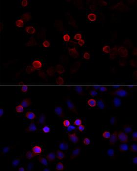 ABP-280 / FLNC Antibody - Immunofluorescence analysis of HeLa cells using FLNC antibody at dilution of 1:100 (40x lens). Blue: DAPI for nuclear staining.