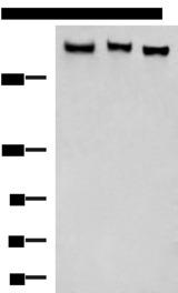 ABP-280 / FLNC Antibody - Western blot analysis of LO2 NIH/3T3 A172 cell lysates  using FLNC Polyclonal Antibody at dilution of 1:750