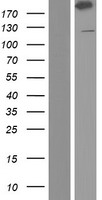 ABP-280 / FLNC Protein - Western validation with an anti-DDK antibody * L: Control HEK293 lysate R: Over-expression lysate