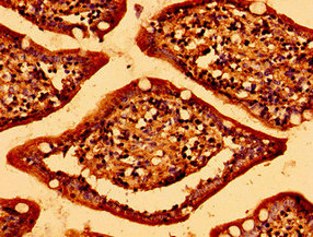 ABR Antibody - Immunohistochemistry image of paraffin-embedded human small intestine tissue at a dilution of 1:100
