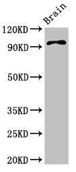ABR Antibody - Positive Western Blot detected in Mouse brain tissue. All lanes: ABR antibody at 3.4 µg/ml Secondary Goat polyclonal to rabbit IgG at 1/50000 dilution. Predicted band size: 98, 94, 36, 93 KDa. Observed band size: 98 KDa