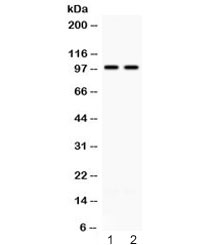 ABR Antibody - Western blot testing of 1) rat brain and 2) mouse brain lysate with ABR antibody at 0.5ug/ml. Predicted molecular weight ~98 kDa.
