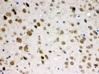 ABR Antibody - IHC testing of FFPE mouse brain with ABR antibody at 1ug/ml. HIER: steam in pH6 citrate buffer and allow to cool prior to staining.