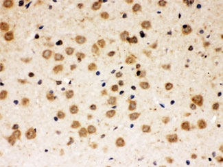 ABR Antibody - IHC testing of FFPE rat brain with ABR antibody at 1ug/ml. HIER: steam in pH6 citrate buffer and allow to cool prior to staining.