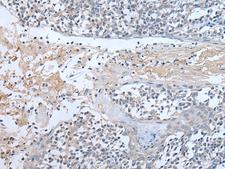 ABR Antibody - Immunohistochemistry of paraffin-embedded Human tonsil tissue  using ABR Polyclonal Antibody at dilution of 1:50(×200)