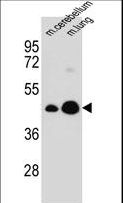 ABRI / ITM2B Antibody - ITM2B Antibody western blot of mouse cerebellum,lung tissue lysates (35 ug/lane). The ITM2B antibody detected the ITM2B protein (arrow).