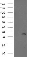 ABRI / ITM2B Antibody - HEK293T cells were transfected with the pCMV6-ENTRY control (Left lane) or pCMV6-ENTRY ITM2B (Right lane) cDNA for 48 hrs and lysed. Equivalent amounts of cell lysates (5 ug per lane) were separated by SDS-PAGE and immunoblotted with anti-ITM2B.