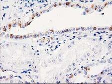 ABRI / ITM2B Antibody - IHC of paraffin-embedded Human Kidney tissue using anti-ITM2B mouse monoclonal antibody.