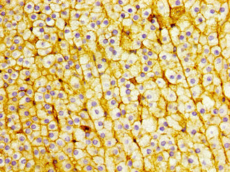 ABRI / ITM2B Antibody - Immunohistochemistry image at a dilution of 1:400 and staining in paraffin-embedded human adrenal gland tissue performed on a Leica BondTM system. After dewaxing and hydration, antigen retrieval was mediated by high pressure in a citrate buffer (pH 6.0) . Section was blocked with 10% normal goat serum 30min at RT. Then primary antibody (1% BSA) was incubated at 4 °C overnight. The primary is detected by a biotinylated secondary antibody and visualized using an HRP conjugated SP system.