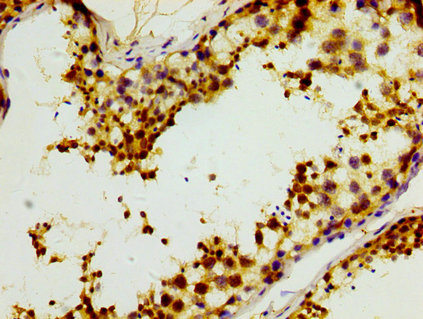 ABRI / ITM2B Antibody - Immunohistochemistry image at a dilution of 1:400 and staining in paraffin-embedded human testis tissue performed on a Leica BondTM system. After dewaxing and hydration, antigen retrieval was mediated by high pressure in a citrate buffer (pH 6.0) . Section was blocked with 10% normal goat serum 30min at RT. Then primary antibody (1% BSA) was incubated at 4 °C overnight. The primary is detected by a biotinylated secondary antibody and visualized using an HRP conjugated SP system.