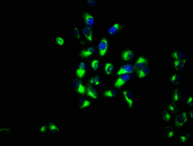 ABRI / ITM2B Antibody - Immunofluorescence staining of Hela cells with ITM2B Antibody at 1:133, counter-stained with DAPI. The cells were fixed in 4% formaldehyde, permeabilized using 0.2% Triton X-100 and blocked in 10% normal Goat Serum. The cells were then incubated with the antibody overnight at 4°C. The secondary antibody was Alexa Fluor 488-congugated AffiniPure Goat Anti-Rabbit IgG(H+L).