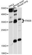 ABRI / ITM2B Antibody - Western blot analysis of extracts of various cell lines, using ITM2B antibody at 1:1000 dilution. The secondary antibody used was an HRP Goat Anti-Rabbit IgG (H+L) at 1:10000 dilution. Lysates were loaded 25ug per lane and 3% nonfat dry milk in TBST was used for blocking. An ECL Kit was used for detection and the exposure time was 30s.