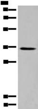 ABRI / ITM2B Antibody - Western blot analysis of Rat kidney tissue lysate  using ITM2B Polyclonal Antibody at dilution of 1:500