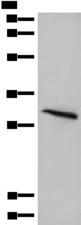 ABRI / ITM2B Antibody - Western blot analysis of Mouse lung tissue lysate  using ITM2B Polyclonal Antibody at dilution of 1:400
