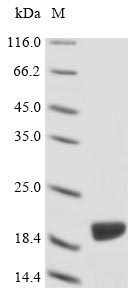 ACTA1 / Skeletal Muscle Actin Protein - (Tris-Glycine gel) Discontinuous SDS-PAGE (reduced) with 5% enrichment gel and 15% separation gel.